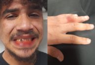 Jovem denuncia agressão de seguranças da CPTM após pular catraca em SP