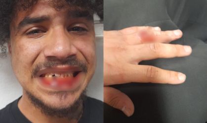 Jovem denuncia agressão de seguranças da CPTM após pular catraca em SP