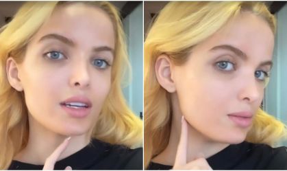 Giovanna Chaves faz harmonização para ficar parecida com Angelina Jolie