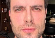 Ex-BBB Gustavo mostra resultado de implante capilar: "Um calvo morria"