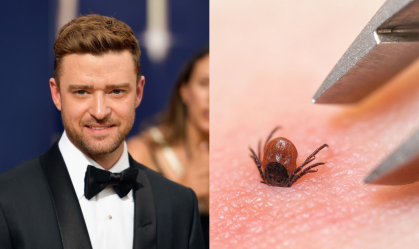Após caso de Justin Timberlake, buscas pela doença de Lyme disparam