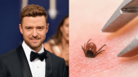 Após caso de Justin Timberlake, buscas pela doença de Lyme disparam