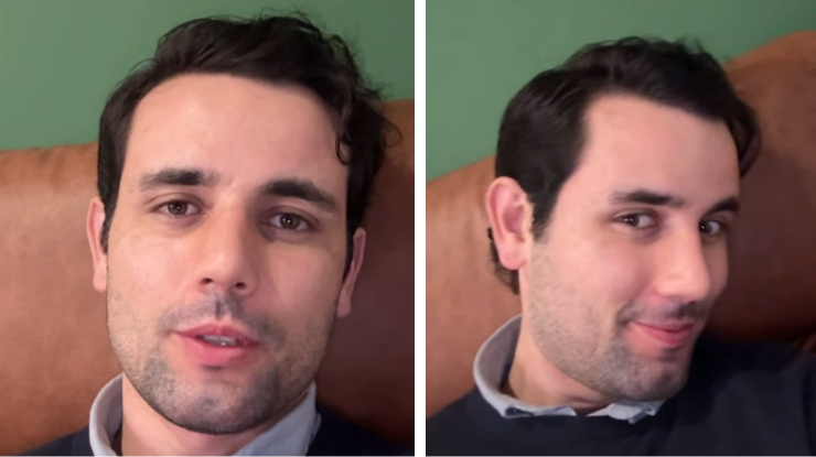 Matteus Amaral mostra resultado de cirurgia no nariz • Instagram/ Matteus Amaral