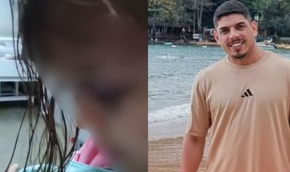 Polícia investiga outras agressões à criança espancada por padrasto no RJ