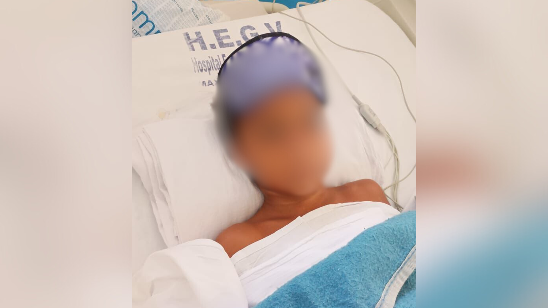 CRIANÇA AMPUTA BOMBA (3)