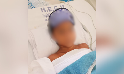 Menino de 8 anos tem mão amputada ao confundir explosivo com pedal no Rio