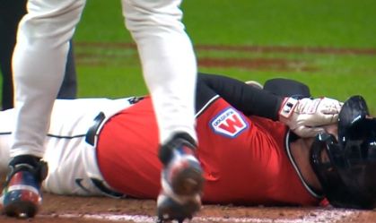 Jogador de beisebol é hospitalizado após bolada no rosto a 159km/h