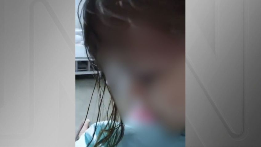 Menina agredida por Linneker Steven Siqueira Ramos Silva • Reprodução