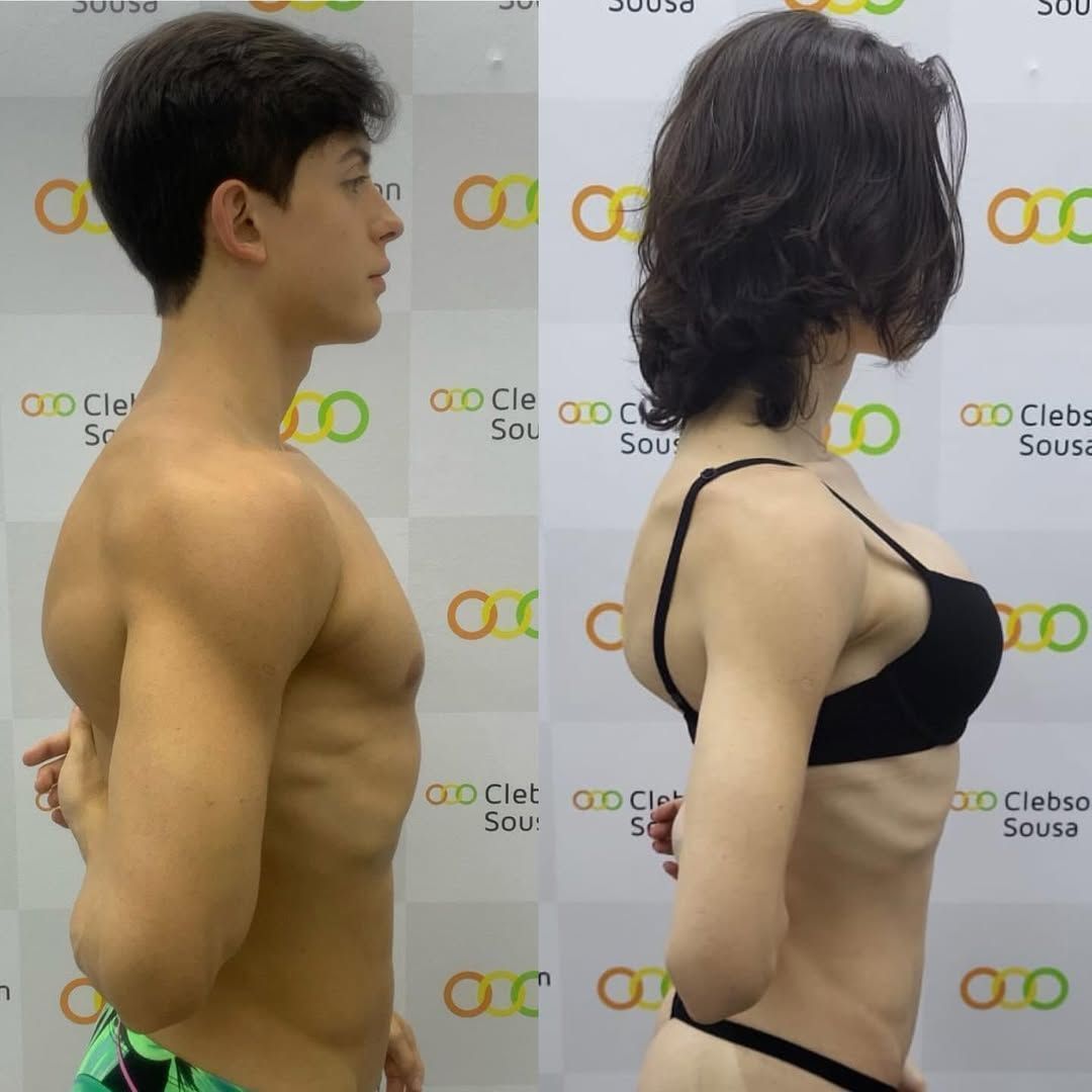Antes e depois Bella Longuinho • Reprodução/Instagram