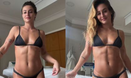 Musa do Salgueiro, Bruna Griphao exibe resultado de drenagem linfática