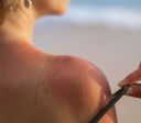 Tan Maxxing: por que fugir da trend do bronzeado extremo?