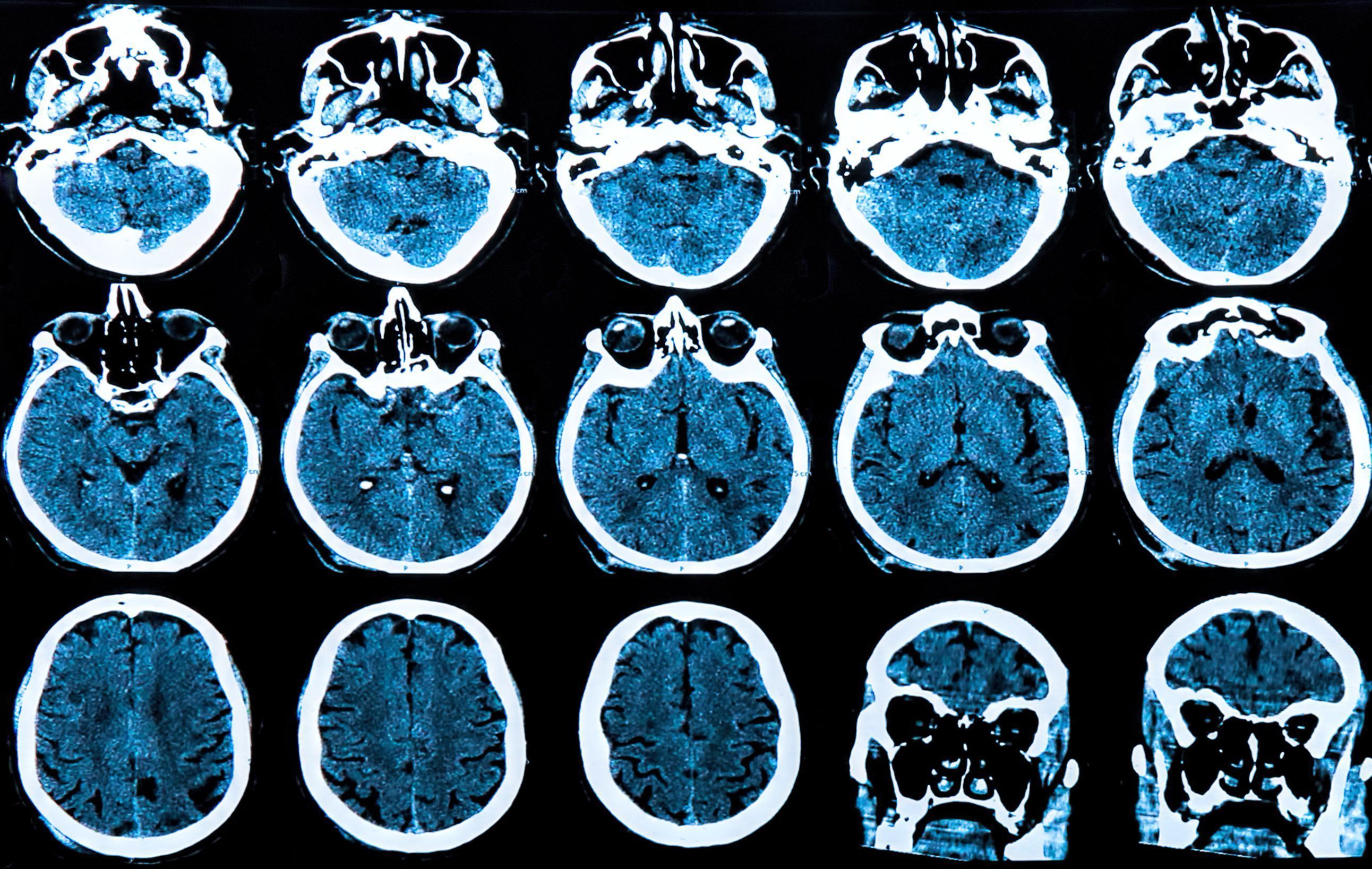 human brain