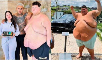 Influenciador Gordão da XJ perde 115 kg e atinge peso para bariátrica