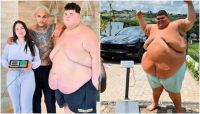Influenciador Gordão da XJ perde 115 kg e atinge peso para bariátrica