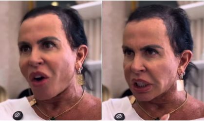 Com alopecia, Gretchen passa por transformação no visual