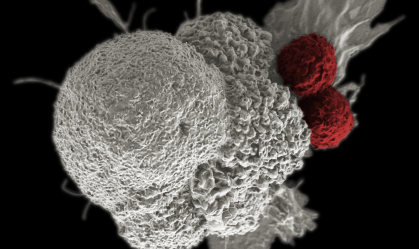 Câncer é a principal causa de morte em 670 cidades do Brasil, diz estudo