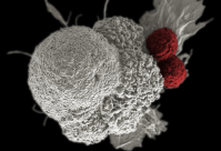 Câncer é a principal causa de morte em 670 cidades do Brasil, diz estudo