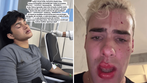 Luan Alencar (à dir.) está no hospital; e Caio Cerqueira mostra ferimentos no rosto