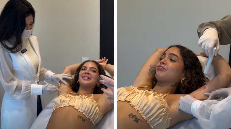 Mel Maia aplica botox nas axilas • Instagram/ Mel Maia