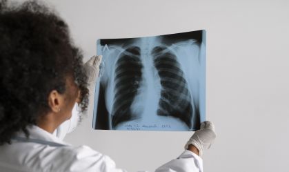 Mais de 60% dos exames de imagem no Brasil são feitos pelo SUS, diz estudo