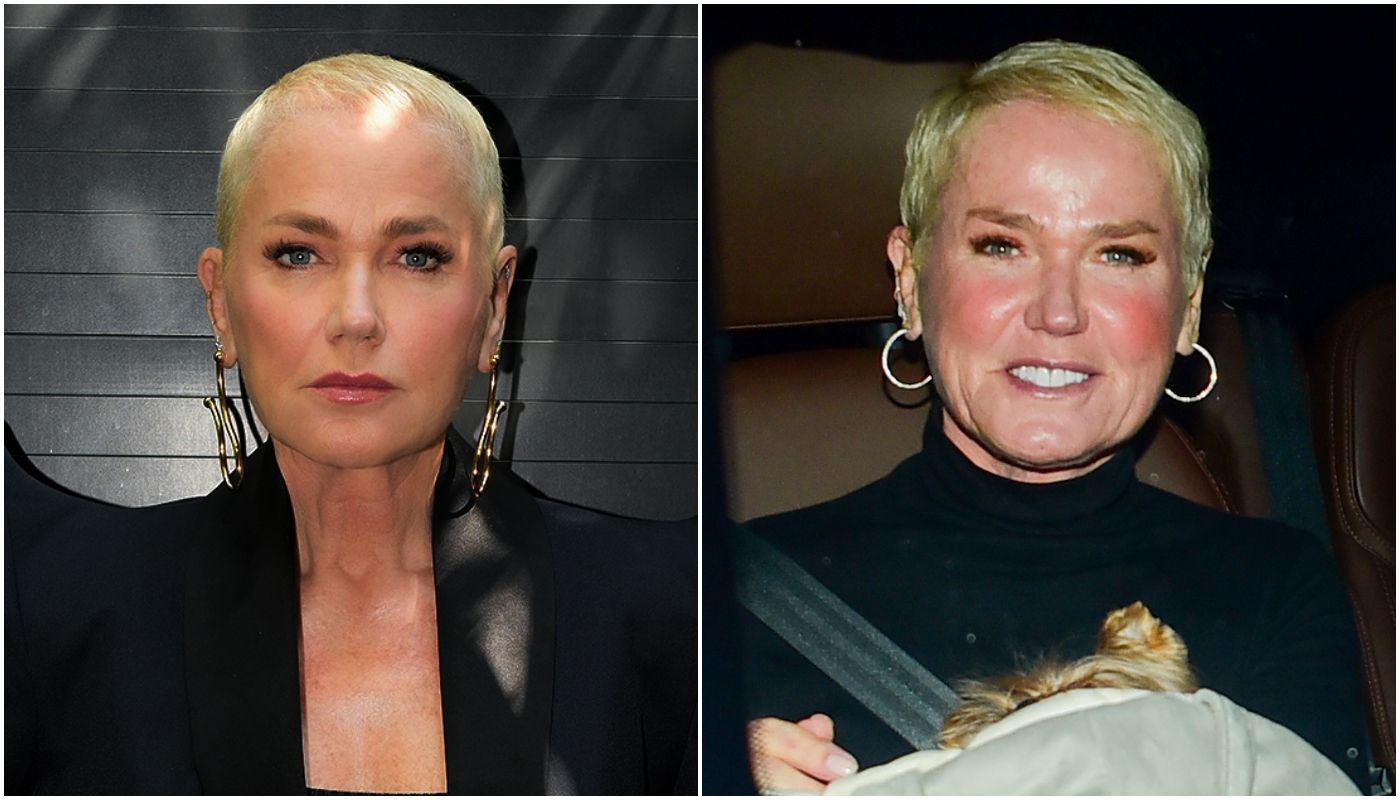 Xuxa aparece com cabelos mais volumosos após transplante capilar; compare • Instagram / Xuxa