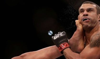 Vitor Belfort aparece desfigurado após procedimento; veja antes e depois