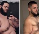 Influenciador viraliza ao remover mais 7 kg de pele após emagrecer