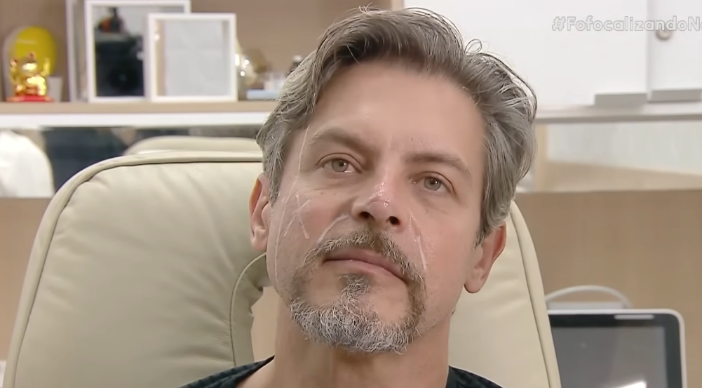 luigi-baricelli-harmonização-facial