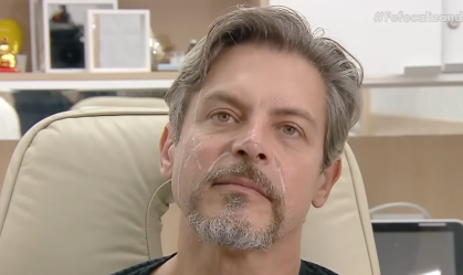 Luigi Baricelli faz harmonização facial; veja o antes e depois