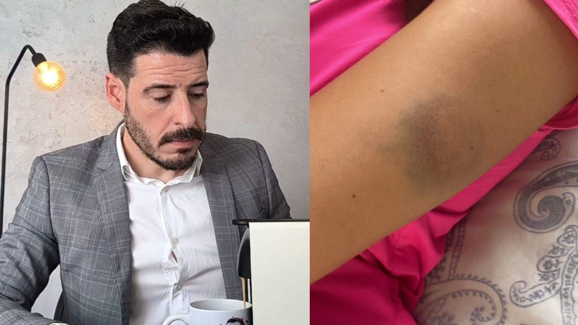agressões-thiago-schutz