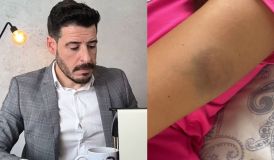 Influenciador “Calvo do Campari” é preso por agressão contra a namorada