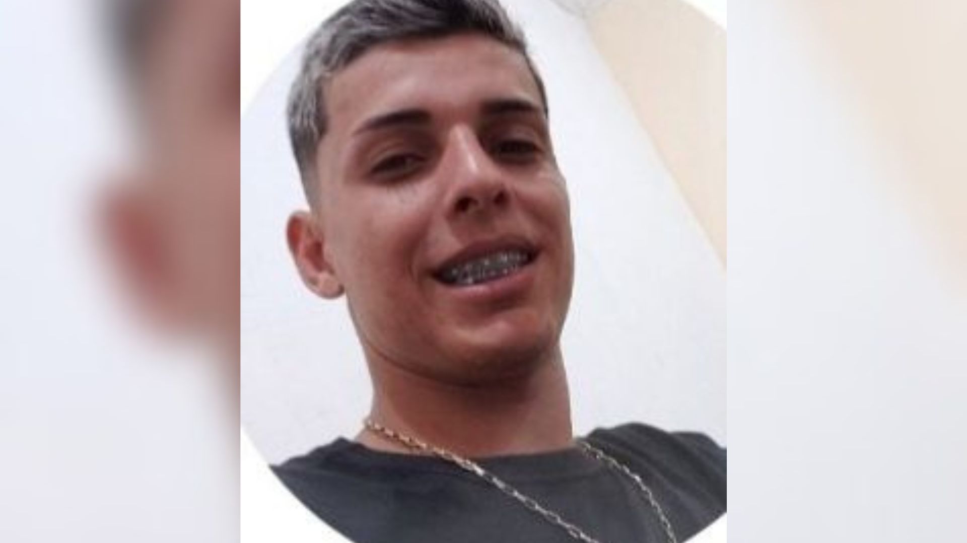 JOVEM BALEADO RJ