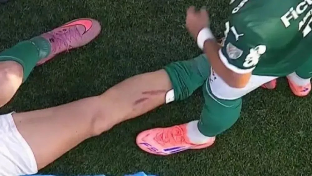 Fuchs sofreu entrada forte de Pulgar