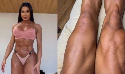 Gracyanne Barbosa responde críticas sobre aparência de suas pernas; veja