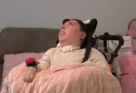 Jovem que nasceu sem cérebro completa 20 anos, contrariando previsão médica