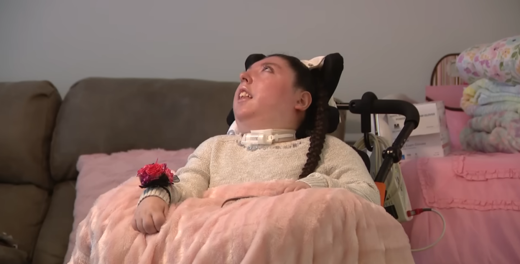 Jovem que nasceu sem cérebro completa 20 anos, contrariando