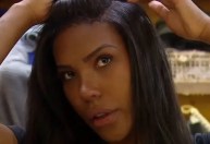 Alopecia areata: entenda doença de Carol Lekker e seus tratamentos