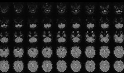 Cientista traduz pensamentos em palavras usando ressonância magnética