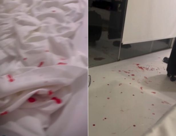Lençol manchado de sangue no quarto de Dado Dolabella e Marcela Tomaszewski • Reprodução/Instagram