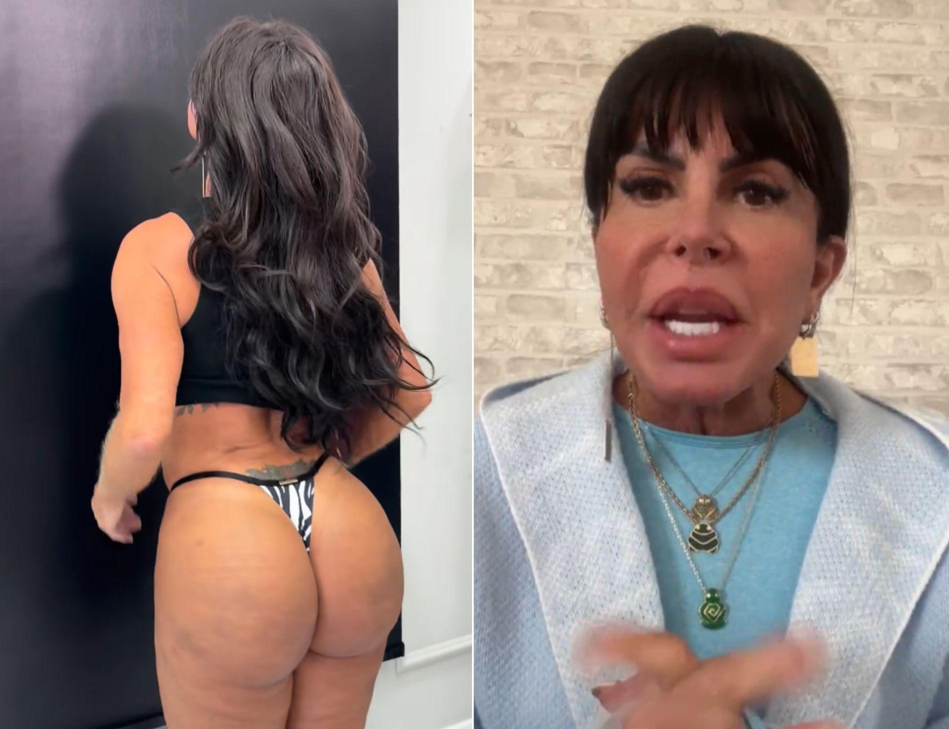 Gretchen detalha procedimento e comemora: "Minha bunda, minha perna estão lindas" • Reprodução/Instagram