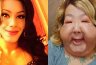 Médico mostra os resultados de cirurgia de reconstrução de Juju do Pix