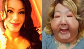 Médico mostra os resultados de cirurgia de reconstrução de Juju do Pix