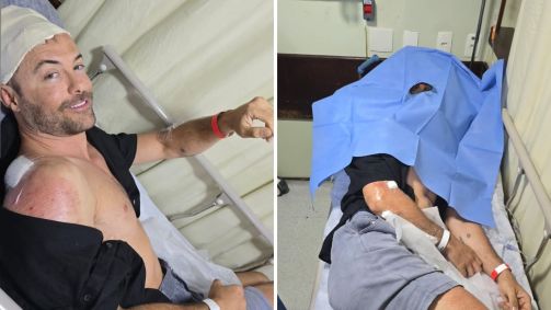Kayky Brito sofre acidente de bicicleta