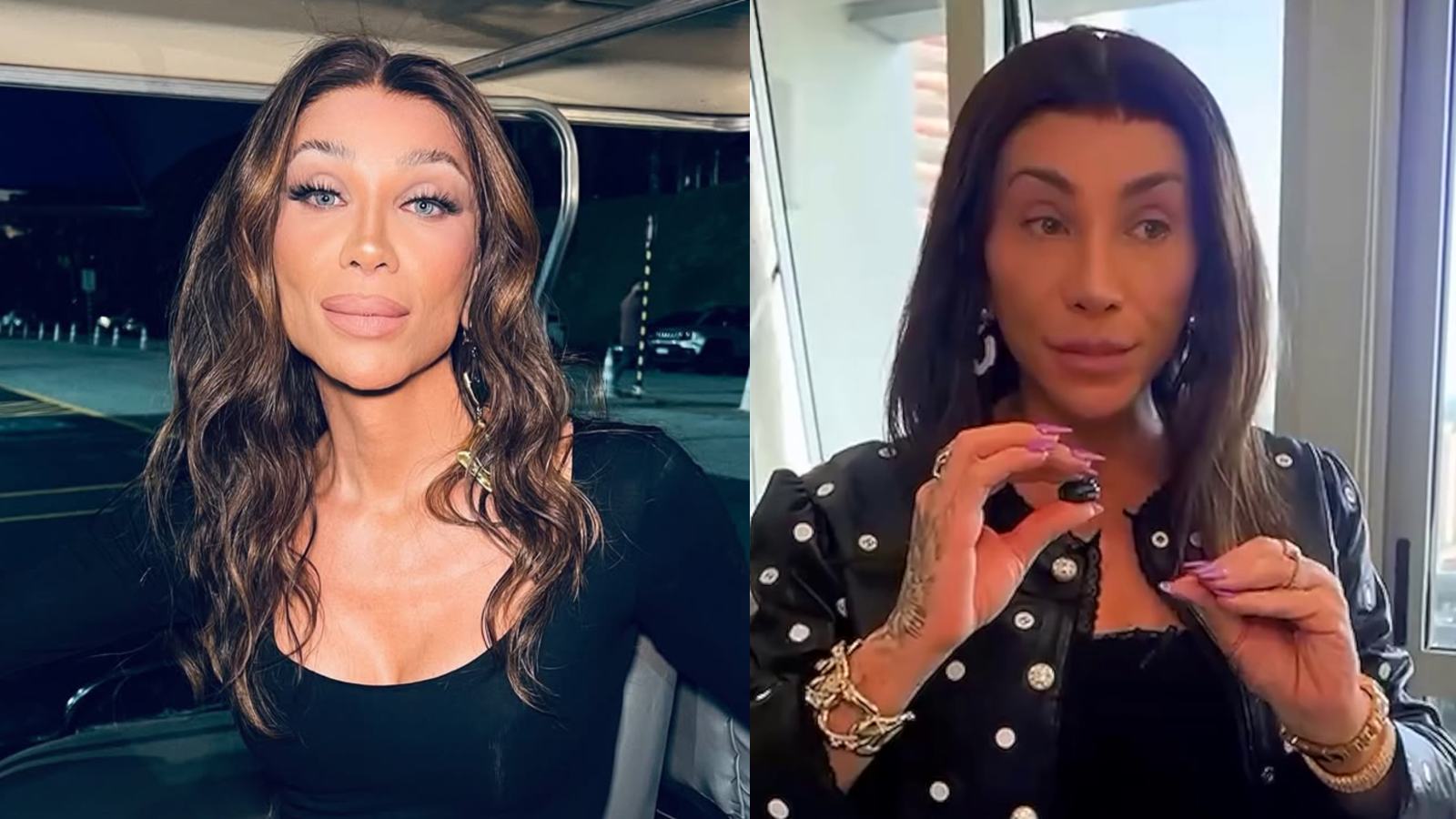 Maya Massafera mostrou o antes e depois de sua cirurgia no rosto • Instagram/Maya Massafera