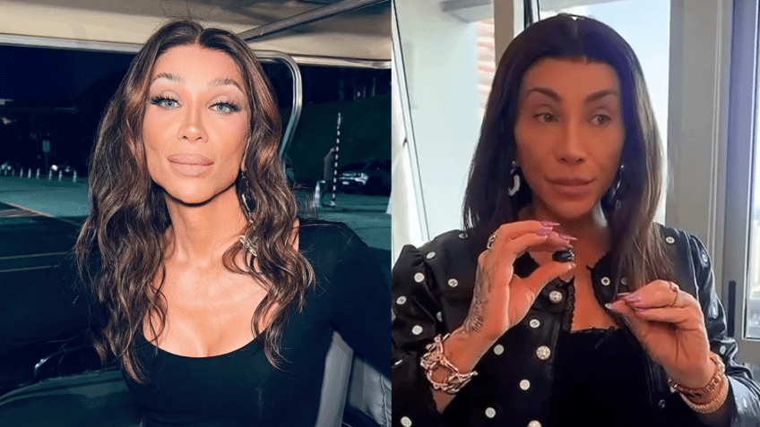 Maya Massafera mostrou o antes e depois de sua cirurgia no rosto • Instagram/Maya Massafera