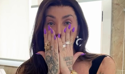 Maya Massafera mostra rosto pela 1ª vez após retirada de ossos do maxilar