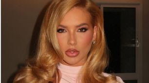 Virginia mostra antes e depois de procedimento estético no rosto: "Glow up"