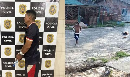 Homem é preso após atear fogo na companheira e ferir criança no Pará