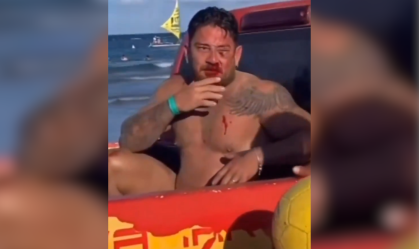 "Tinha uns 30 em cima da gente", diz casal agredido em Porto de Galinhas