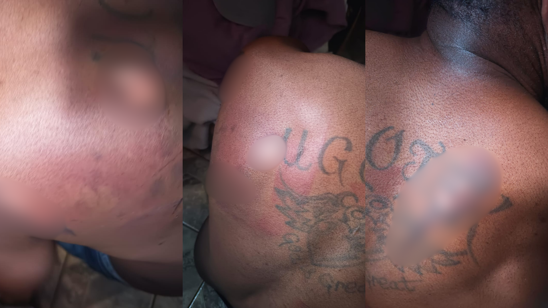 Emmanuel estava com ferimentos de agressões • Reprodução/Polícia Civil